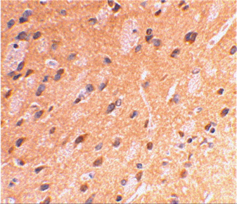 Immunohistochemical staining of rat brain using APP antibody at 2 ug/mL.